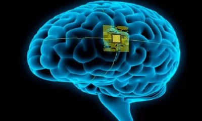 inteligencia artificial usada médicamente para el habla