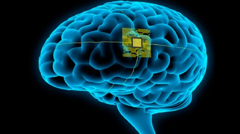 inteligencia artificial usada médicamente para el habla
