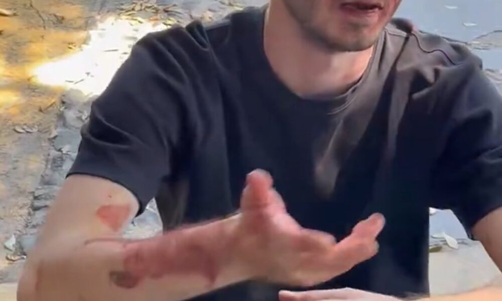 Agreden a fotógrafo en funeral de “El Mencho”