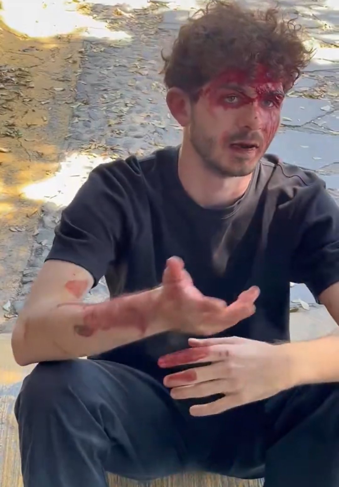 Agreden a fotógrafo en funeral de “El Mencho”